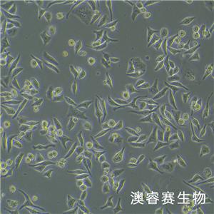 Hela（人宫颈癌细胞）,Hela