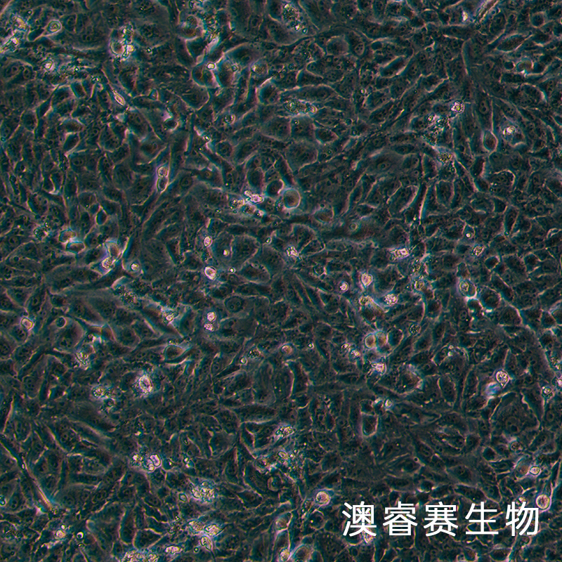 769-P（人腎細(xì)胞腺癌細(xì)胞）,769-P