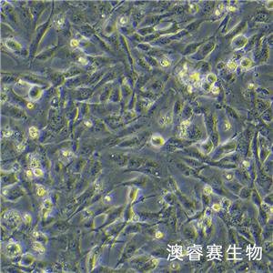 786-O（人腎透明細(xì)胞腺癌細(xì)胞）