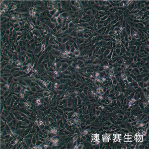 769-P（人腎細(xì)胞腺癌細(xì)胞）,769-P