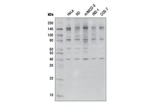 O-GlcNAc（CTD110.6）小鼠单克隆抗体,O-GlcNAc (CTD110.6) Mouse mAb
