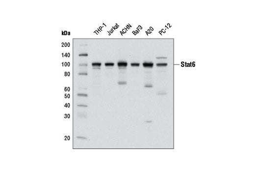 Stat6（D3H4）兔单克隆抗体,Stat6 (D3H4) Rabbit mAb
