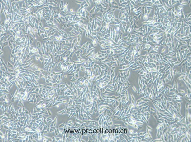HGC-27细胞 (人胃癌细胞(未分化)) (STR鉴定正确)CL-0107,HGC-27 Cells Line;HGC27