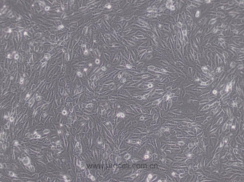 EA.hy926细胞 (人脐静脉细胞融合细胞) (STR鉴定正确)CL-0272,EA.hy926 Cells Line;EA. hy 926;EA hy 926;EAhy 926;EAHY-926;EA.Hy926;EA.hy926;EAhy926;EaHy926;Eahy926