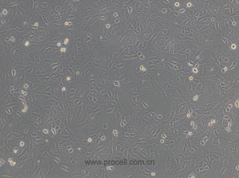 Vero细胞 (非洲绿猴肾细胞)(种属鉴定正确)CL-0242,Vero Cells Line;VERO;Verda reno