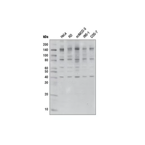 O-GlcNAc（CTD110.6）小鼠单克隆抗体,O-GlcNAc (CTD110.6) Mouse mAb