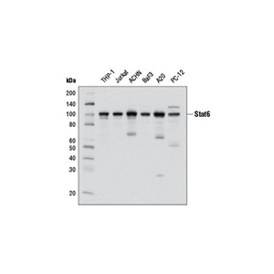 Stat6（D3H4）兔单克隆抗体,Stat6 (D3H4) Rabbit mAb