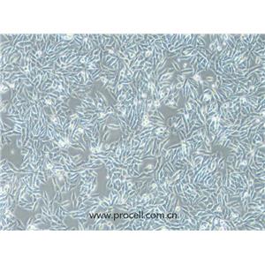 HGC-27细胞 (人胃癌细胞(未分化)) (STR鉴定正确)CL-0107,HGC-27 Cells Line;HGC27