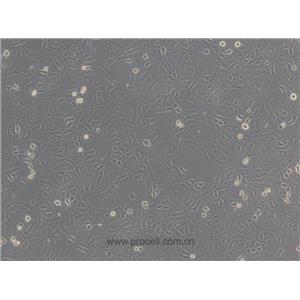 Vero细胞 (非洲绿猴肾细胞)(种属鉴定正确)CL-0242,Vero Cells Line;VERO;Verda reno