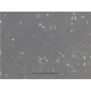 Vero细胞 (非洲绿猴肾细胞)(种属鉴定正确)CL-0242,Vero Cells Line;VERO;Verda reno