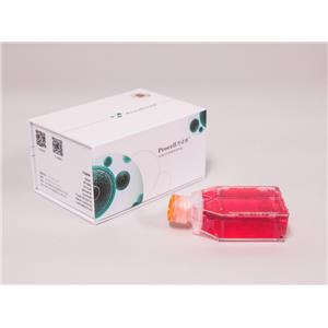 Ishikawa细胞 (人子宫内膜癌细胞) (STR鉴定正确)CL-0283