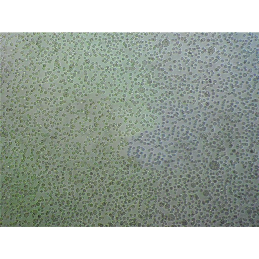 HCT 15 Cells人结直肠腺癌细胞源头保藏中心|STR图谱,HCT 15 Cells