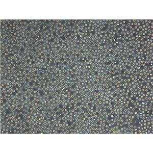 MT-4 Cells人急性淋巴母细胞白血病细胞种子库代次低,MT-4 Cells