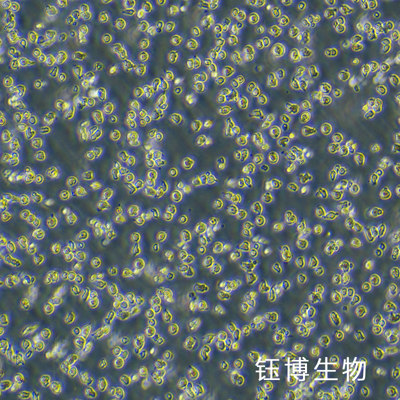 HPB-ALL（兒童 T 急性淋巴細胞白血?。℡B-75965HC,HPB-ALL