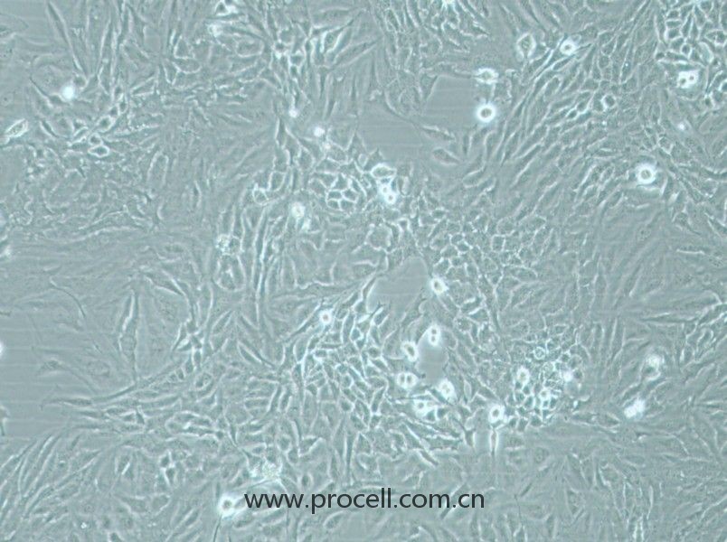 Hela細胞 (人宮頸癌細胞) (STR鑒定正確)CL-0101,Hela Cells Line;HELA;Hela;He La;He-La;Henrietta Lacks cells;Helacyton gartleri