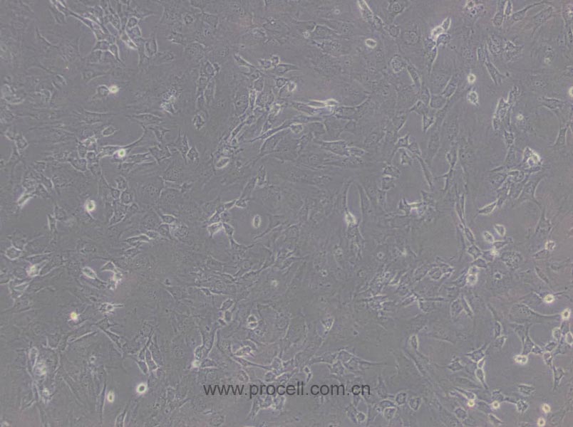 3T3-L1细胞 (小鼠胚胎成纤维细胞) (STR鉴定正确)CL-0006,3T3-L1 Cells Line;3T3 L1;3T3L1;3T3-L1 ad;NIH-3T3-L1;NIH3T3-L1