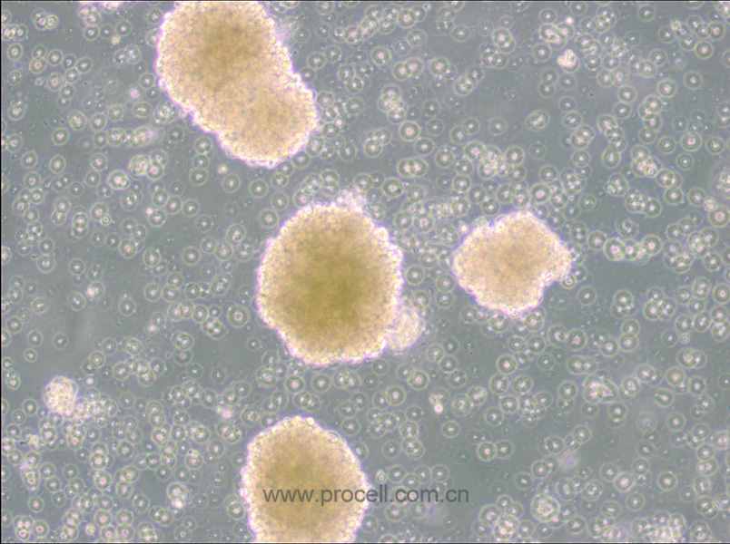NK-92細(xì)胞 (人惡性非霍奇金淋巴瘤患者的自然殺傷細(xì)胞) (STR鑒定正確)CL-0530,NK-92 Cells Line;NK92;Natural Killer-92;NK-92.05;Neukoplast;aNK