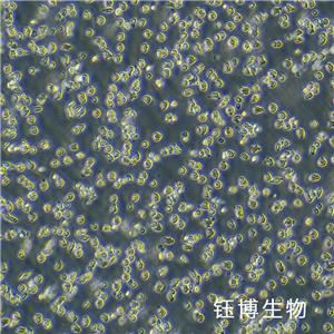 HPB-ALL（儿童 T 急性淋巴细胞白血病）YB-75965HC