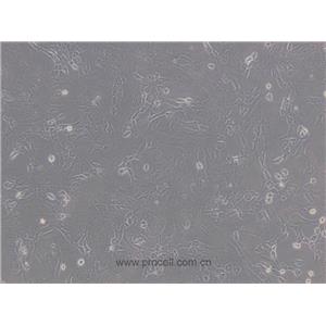3T3-L1细胞 (小鼠胚胎成纤维细胞) (STR鉴定正确)CL-0006,3T3-L1 Cells Line;3T3 L1;3T3L1;3T3-L1 ad;NIH-3T3-L1;NIH3T3-L1