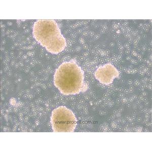 NK-92細(xì)胞 (人惡性非霍奇金淋巴瘤患者的自然殺傷細(xì)胞) (STR鑒定正確)CL-0530,NK-92 Cells Line;NK92;Natural Killer-92;NK-92.05;Neukoplast;aNK