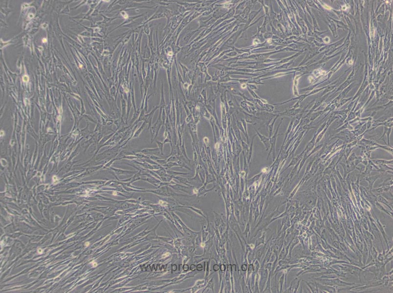 HFL1细胞 (人胚肺成纤维细胞) (STR鉴定正确)CL-0106,HFL1 Cells Line;HFL-1;HFL 1;Human fetal lung fibroblast 1;HFL