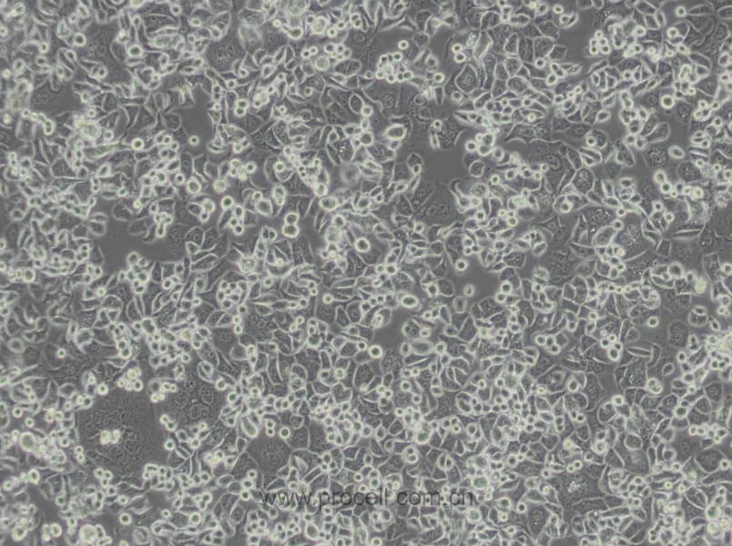 SK-BR-3 细胞[SKBR3细胞] (人乳腺腺癌细胞) (STR鉴定正确)CL-0211,SK-BR-3 [SKBR3] Cells Line;SK-Br-3;Sk-Br-3;SK BR 03;SKBR-3;SKBr-3;SK-BR3;SKBr3;SkBr3;SKBR3