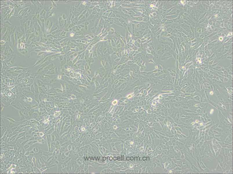 MCF 10A细胞 (人正常乳腺上皮细胞) (STR鉴定正确)CL-0525,MCF 10A Cells Line;MCF 10A;MCF.10A;MCF10A;MCF10a;MCF-10 Attached;Michigan Cancer Foundation-10A