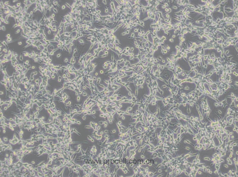 CT26.WT細胞 (小鼠結腸癌細胞) (STR鑒定正確)CL-0071,CT26.WT Cells Line;CT26WT