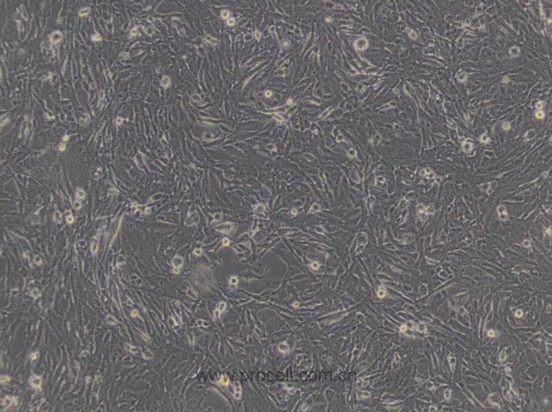U251细胞 (人胶质瘤细胞) (STR鉴定正确)CL-0237,U251 Cells Line;U-251 MG;U-251-MG;U-251_MG;U251-MG;U251MG;U-251;U251;U251n;U251N;251 MG;251MG