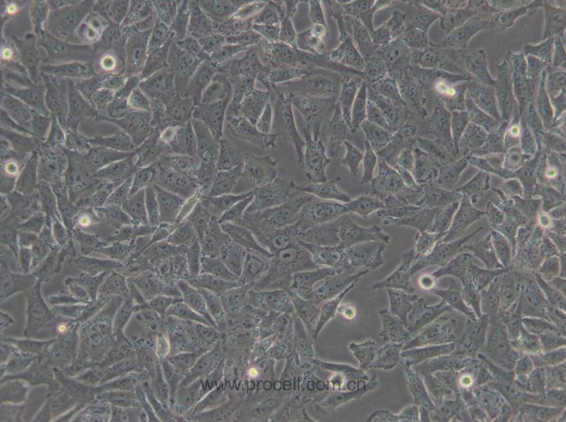 A-375細胞 (人惡性黑色素瘤細胞) (STR鑒定正確)CL-0014,A-375 Cells Line;A 375;A375;A375-MEL;A375-mel;A375mel