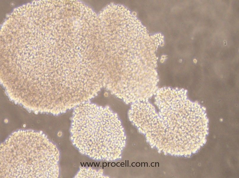 NK-92MI细胞 (人恶性非霍奇金淋巴瘤患者的自然杀伤细胞) (STR鉴定正确)CL-0533,NK-92MI Cells Line;NK-92 MI;NK-92 mi;NK92-MI;NK92MI;NK-92 transfected with MFG-Hil2