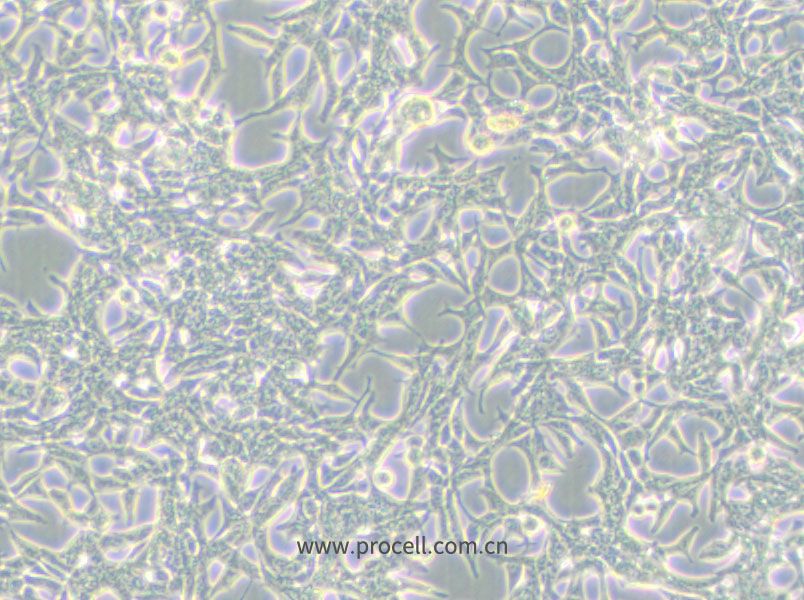 LNCaP clone FGC细胞 (人前列腺癌细胞) (STR鉴定正确)CL-0143,LNCaP clone FGC Cells Line;LNCaP-Clone-FGC;LNCaP.FGC;LNCaP-FGC;LNCaP FGC;LNCaP-ATCC