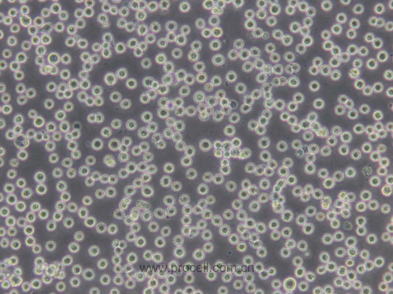 H22細(xì)胞 (小鼠肝癌細(xì)胞) (STR鑒定正確)CL-0341,H22 Cells Line;Hepatoma-22;Hepatoma 22