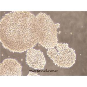 NK-92MI細(xì)胞 (人惡性非霍奇金淋巴瘤患者的自然殺傷細(xì)胞) (STR鑒定正確)CL-0533