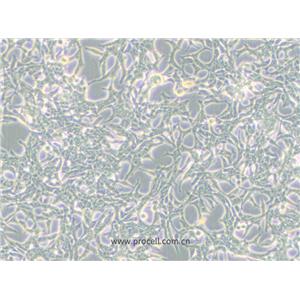 LNCaP clone FGC细胞 (人前列腺癌细胞) (STR鉴定正确)CL-0143,LNCaP clone FGC Cells Line;LNCaP-Clone-FGC;LNCaP.FGC;LNCaP-FGC;LNCaP FGC;LNCaP-ATCC
