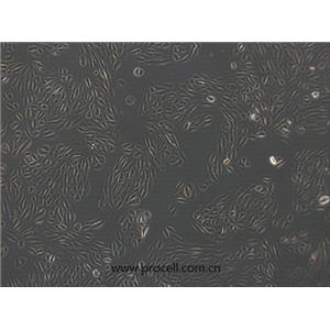 ARPE-19细胞 (人视网膜上皮细胞) (STR鉴定正确)CL-0026