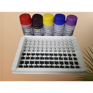 丙酸蛛网菌染料法荧光定量PCR试剂盒,Arachnia propionica