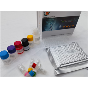 人去乙酰化酶Sirtuin-5(SIRT5)ELISA检测试剂盒,Human Sirtuin 5 (SIRT5) ELISA Kit