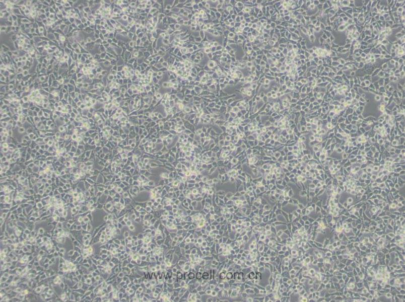 RSC96细胞 (大鼠雪旺细胞) (种属鉴定正确)CL-0199,RSC96 Cells Line;RSC 96;RSC-96