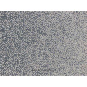 HL-60細(xì)胞 (人原髓細(xì)胞白血病細(xì)胞) (STR鑒定正確)CL-0110