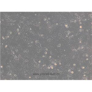 Hepa 1-6細(xì)胞 (小鼠肝癌細(xì)胞) (STR鑒定正確)CL-0105