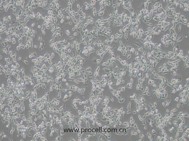 MFC細(xì)胞 (小鼠胃癌細(xì)胞) (STR鑒定正確)CL-0156,MFC Cells Line;Mouse Forestomach Carcinoma