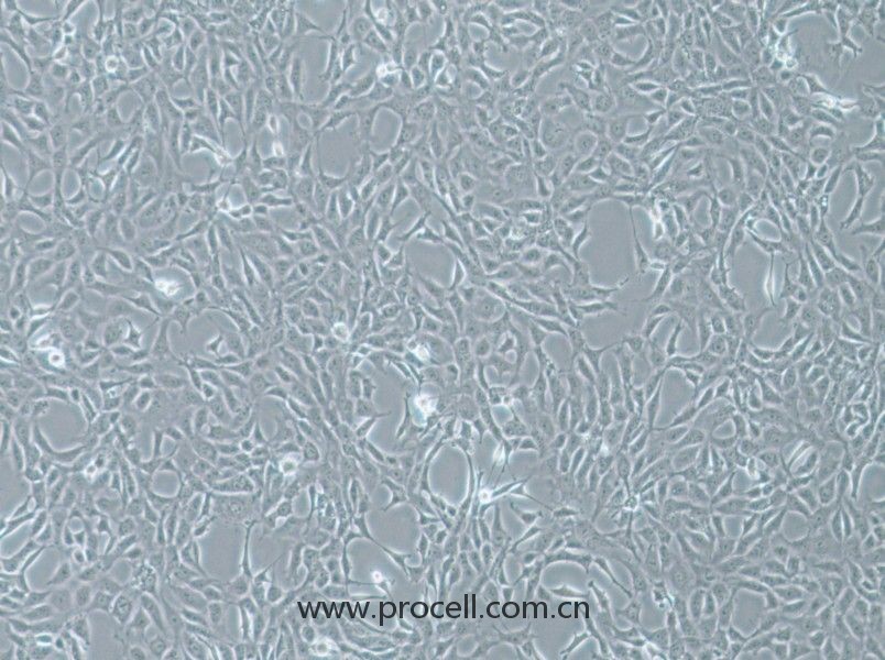 MPC-5細(xì)胞 (小鼠腎足細(xì)胞) (STR鑒定正確)CL-0855,MPC-5  Cells Line;MPC-5
