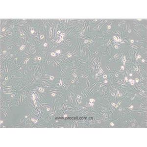 786-O 細胞[786-0細胞] (人腎透明細胞腺癌細胞) (STR鑒定正確)CL-0010,786-O [786-0] Cells Line;786-o;786O;786-0;786.O;786-O RCC;RCC 786-O;RCC_7860;RCC 7860;7860;786-0WT