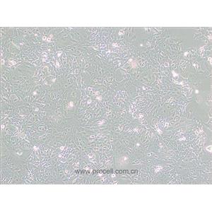 HC11細(xì)胞 (小鼠乳腺上皮細(xì)胞) (STR鑒定正確)CL-0616