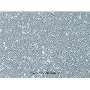MPC-5細(xì)胞 (小鼠腎足細(xì)胞) (STR鑒定正確)CL-0855,MPC-5  Cells Line;MPC-5