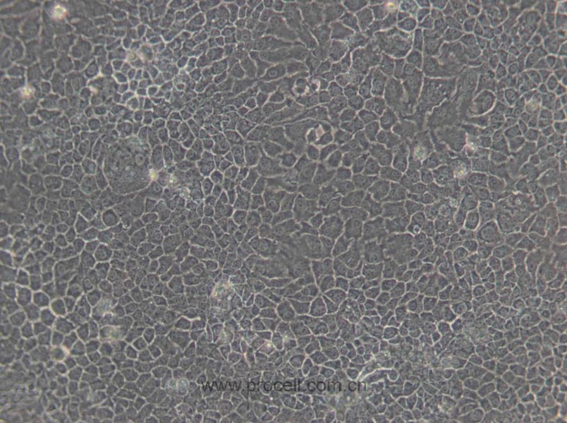 BNL CL.2細胞 (小鼠胚胎肝細胞) (STR鑒定正確)CL-0037,BNL CL.2 Cells Line;BNL-CL.2;BNL CL2;BNL.CL2;BN-CL2;BNCL-2;BNCL2
