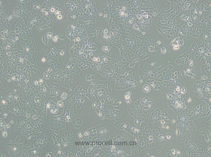 MS751細(xì)胞 (人子宮頸表皮癌細(xì)胞) (STR鑒定正確)CL-0387,MS751 Cells Line;MS-751;MS 751
