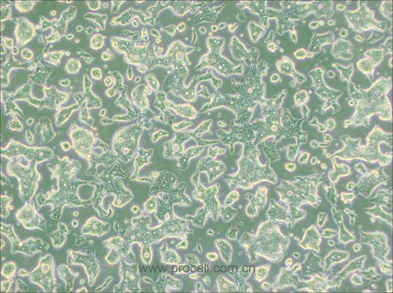 SW948細(xì)胞 (人結(jié)腸腺癌細(xì)胞) (STR鑒定正確)CL-0629,SW948 Cells Line;SW-948;SW 948