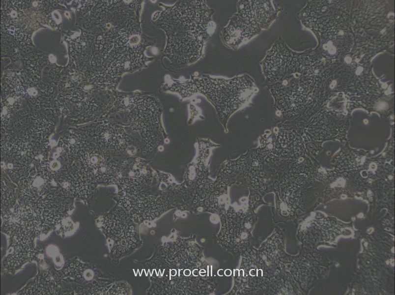 SW1417細(xì)胞 (人結(jié)腸直腸腺癌細(xì)胞) (STR鑒定正確)CL-0835,SW1417 Cells Line  ;SW-1417;SW 1417